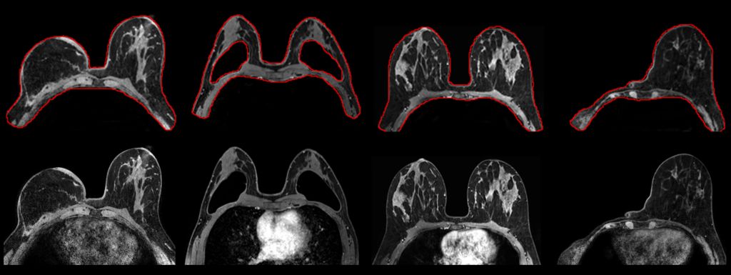 SmartExam Breast