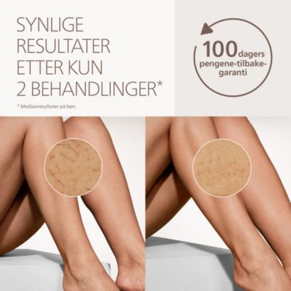 Bilde av produktdetalj