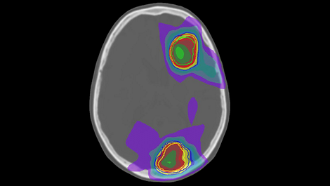 MRCAT Brain MR-RT clinical application