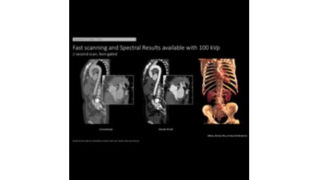 AV spectral insights integrated into primary reading workflows