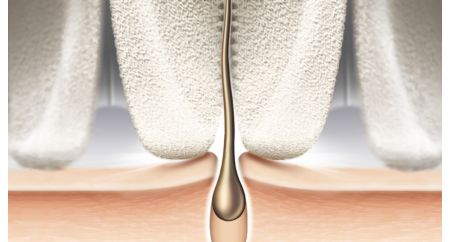 Epilation head of unique ceramic material for better grip