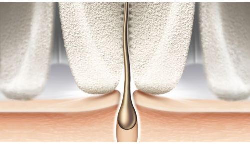 Epilation head in unique ceramic material for better grip