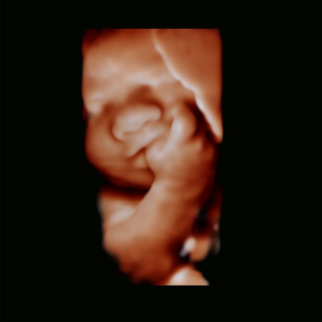 Advanced 3D visualization features- TrueVue, GlassVue and aReveal