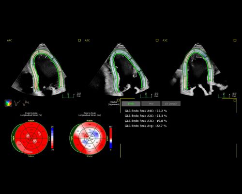 Echo, auto strain AI software application interface
