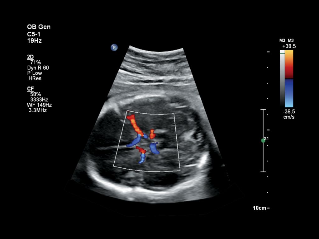 Obstetric image from the Affinit 70