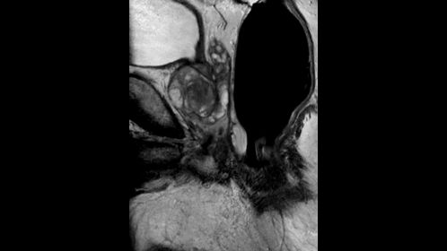 Sagittal T2w TSE