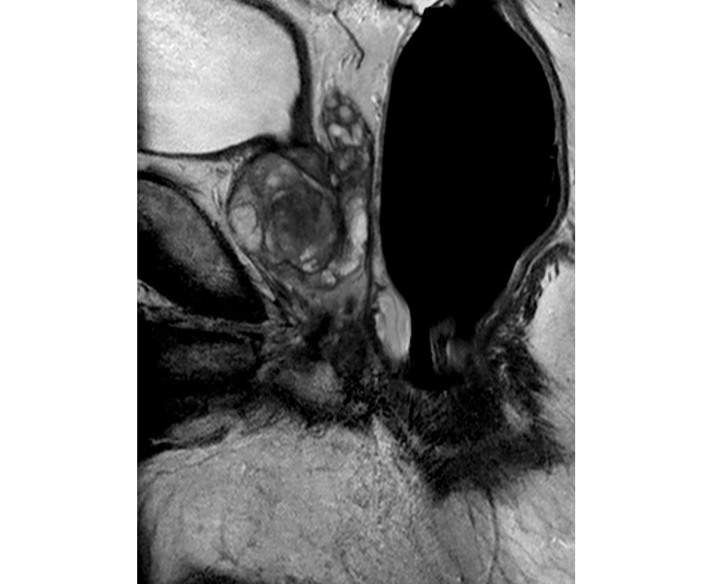 Sagittal T2w TSE