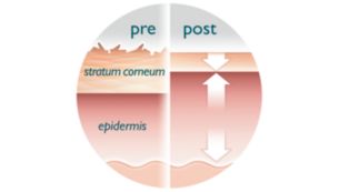 La peau est plus éclatante, plus ferme et plus lisse au toucher en 4 à 6 semaines