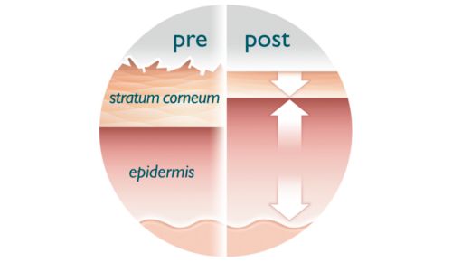 Pelle più luminosa, liscia e rassodata in 4-6 settimane