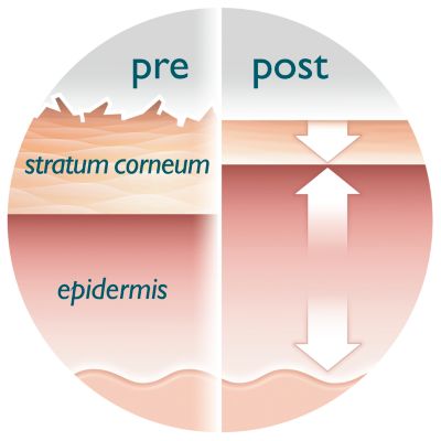 Koža je sjajnija, glađa i čvršća za 4-6 tjedana
