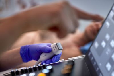 Primer plano de una mano con guante morado sosteniendo un transductor de ultrasonido sobre el panel de control de un ecógrafo, durante la realización de un examen médico