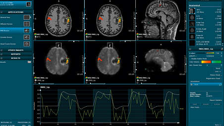 Revisiones de fMRI detalladas