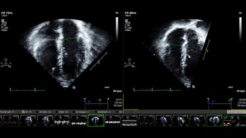 Ultrasound Workspace Pediatric Measurement
