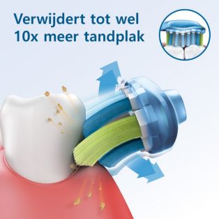 Sonicare DiamondClean 9000 Elektrische sonische tandenborstel met app - Zwart