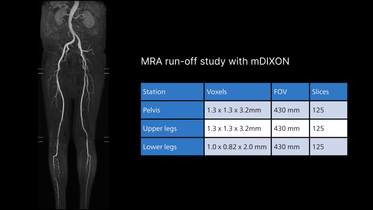 MRA run-off study with mDIXON