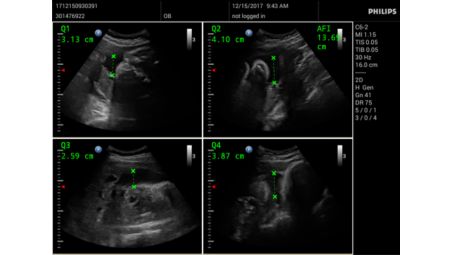 Quad view functionality