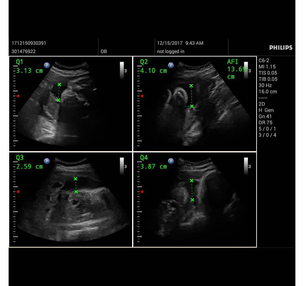 Quad view functionality