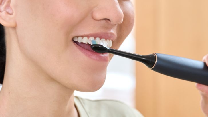 Sonicare Optimal White