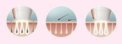 Enjoy smooth skin every day