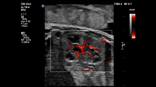 Kidney Flow Viewer eL18-4