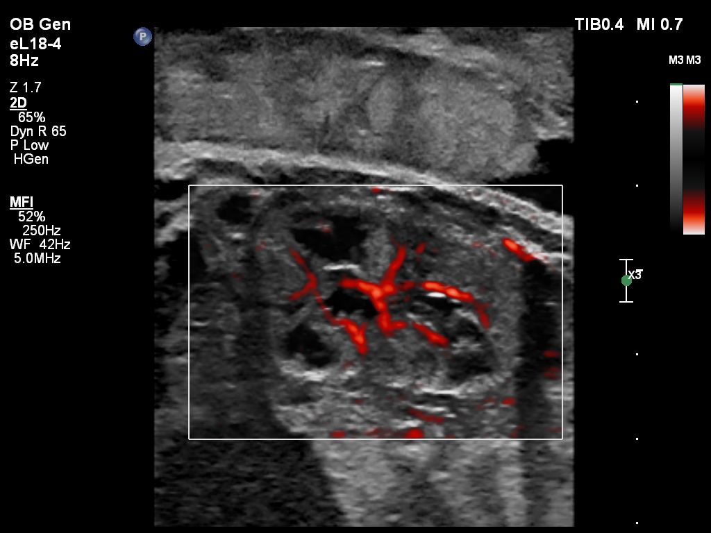 Kidney Flow Viewer eL18-4