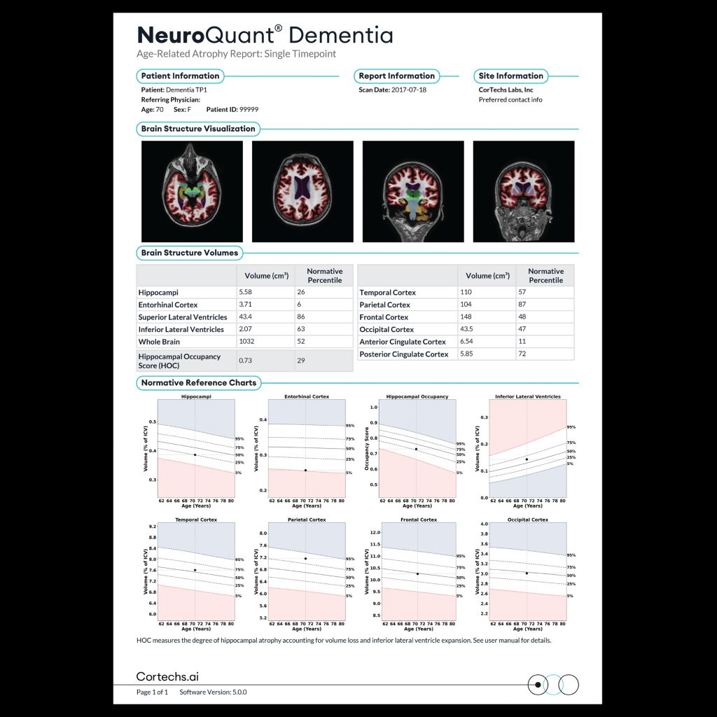 NeuroQuant® quantitative report for dementia diagnosis