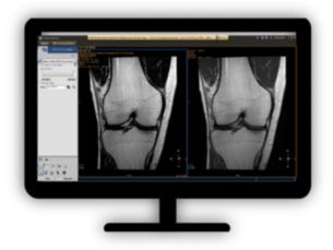 MR Echo Accumulation Optimizing image contrasts for multi-echo MR data