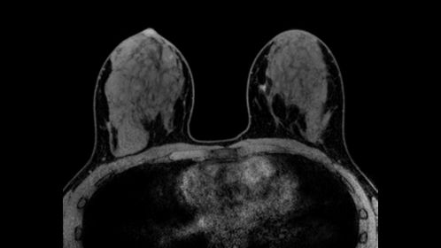 Axial eTHRIVE