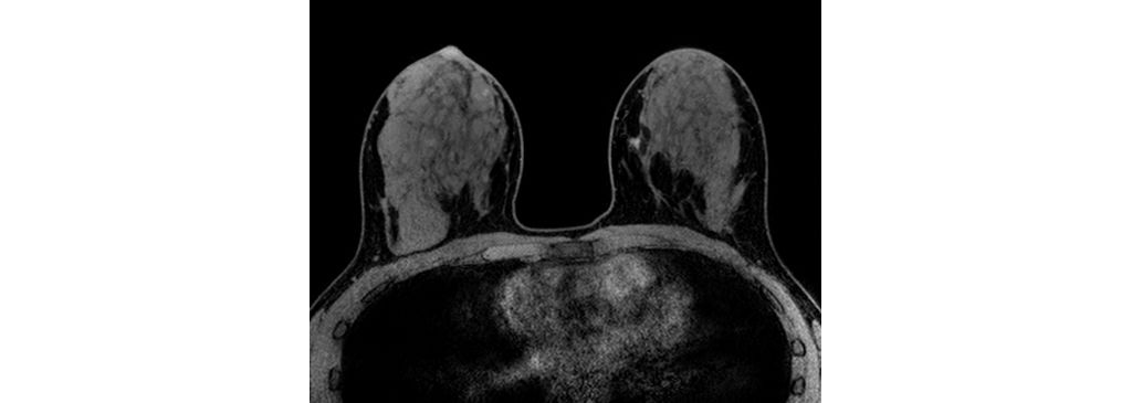 Axial eTHRIVE