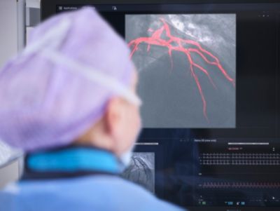 Clinician reviewing coronary imaging on screen