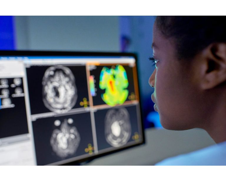 Enhancing brain tumor MRI with APT weighted imaging