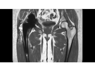 O-MAR - MSK MR Clinical application