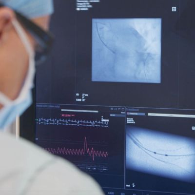 Azurion with SmartIQ Technology See with confidence customer testimonial​