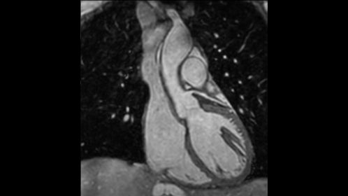 Non-selective 3D bFFE

