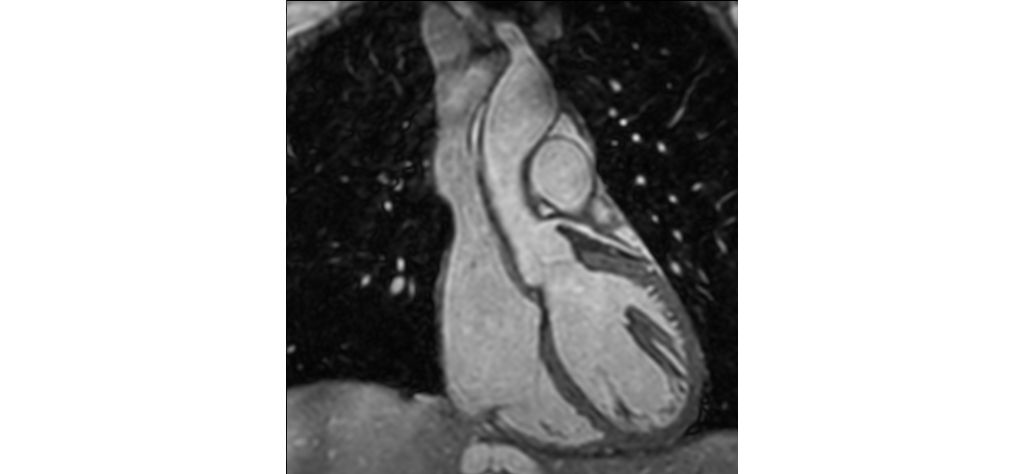 Non-selective 3D bFFE

