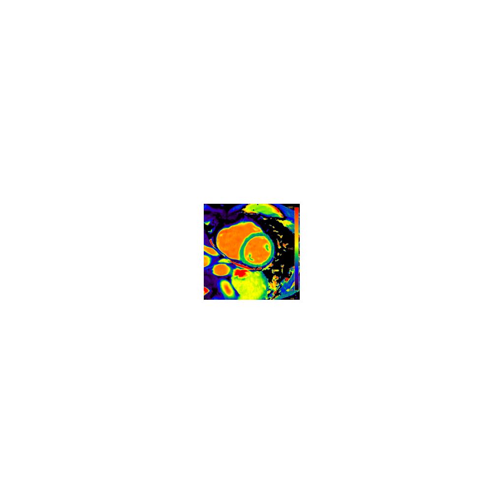 Image clinique cardiaque SmartQuant