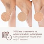 Cordless for ease, personalised treatment with SenseIQ
