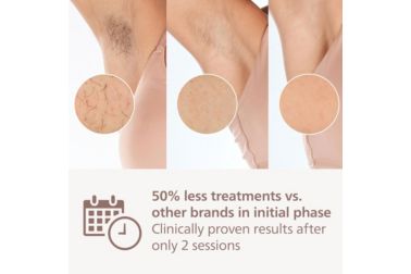 IPL hair removal device: be hair-free for longer