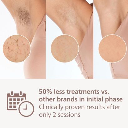 Philips Philips Lumea IPL 9900 Series