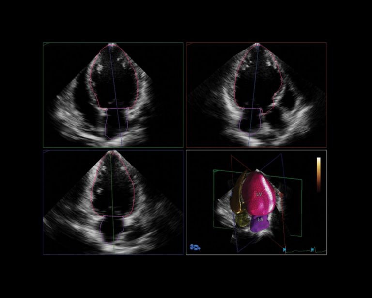 HeartModel clinical image