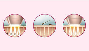 Dermatologlarla birlikte geliştirilen, evde kullanıma yönelik uzman IPL teknolojisi