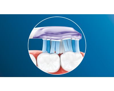 Adaptive cleaning technology