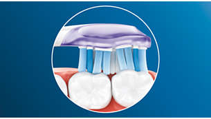 歯や歯ぐきの形状にフィットしてしっかり歯垢を除去