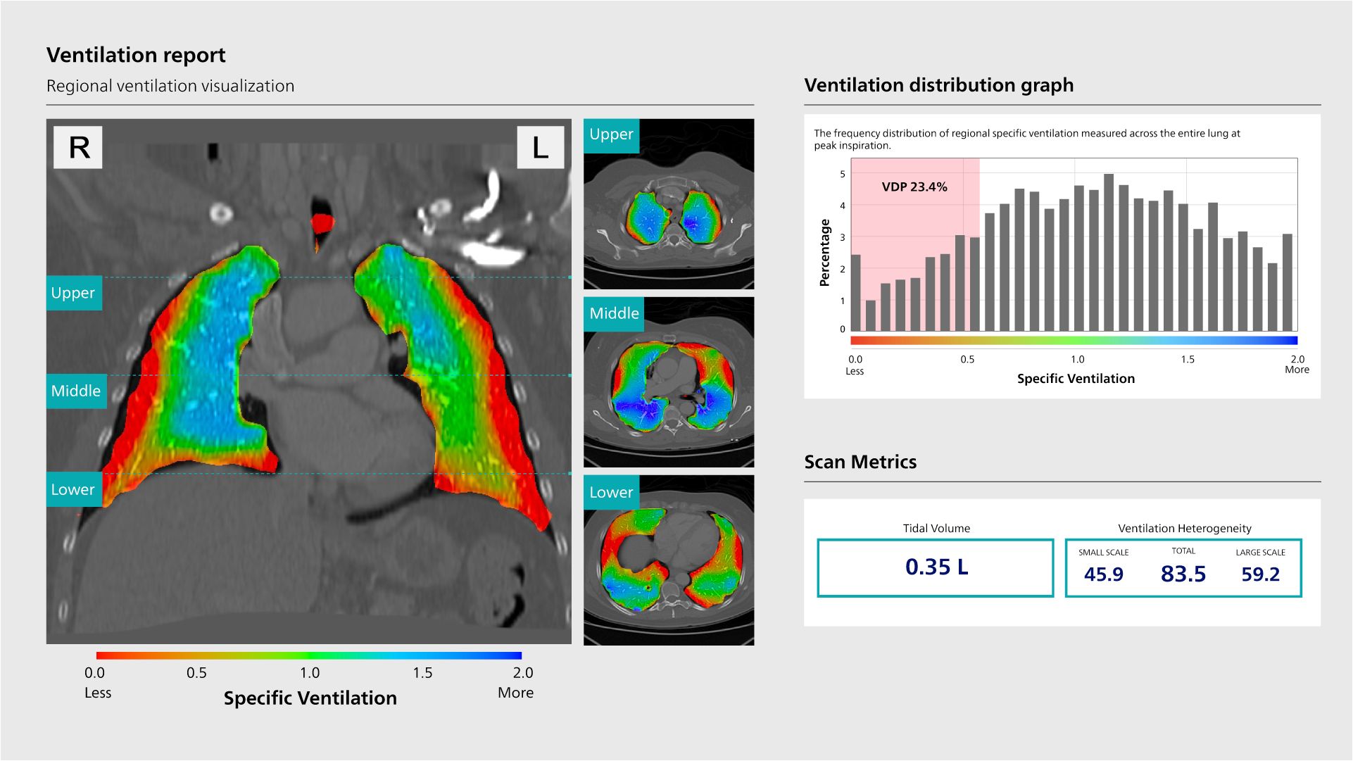 Lung scan