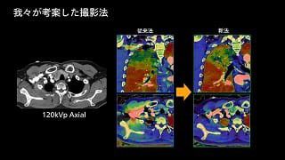 case 89
肺血栓塞栓症ルールアウト検査の撮影法
