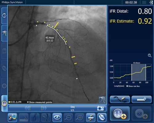 image of Diffuse disease