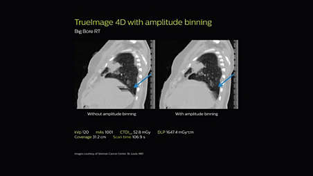 tool for kit healthcare advance planning Philips RT Bore Big tool for kit healthcare advance planning Philips RT Bore Big