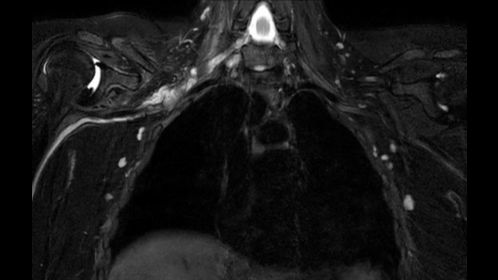 3D NerveVIEW
