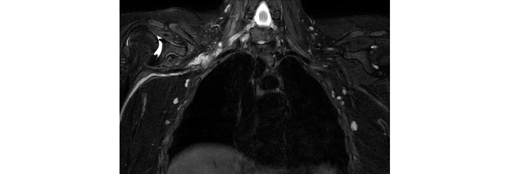 3D NerveVIEW