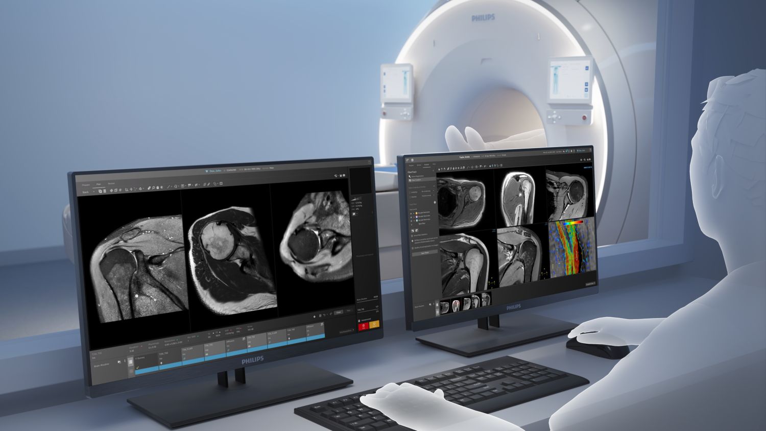 OneSite Smart Workflow integrated post processing with guidance and automation.